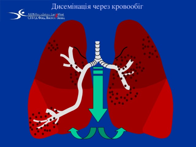 Дисемінація через кровообіг  