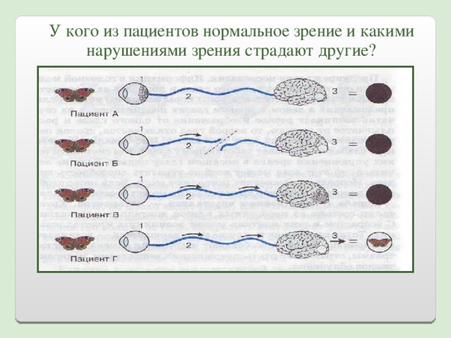 Рассмотрите рисунок 138 укажите у кого из пациентов зрение нормальное и какими нарушениями зрения