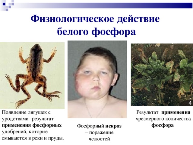Физиологическое действие  белого фосфора Результат применения чрезмерного количества фосфора  Появление лягушек с уродствами -результат применения  фосфорных удобрений, которые смываются в реки и пруды , Фосфорный некроз – поражение челюстей  