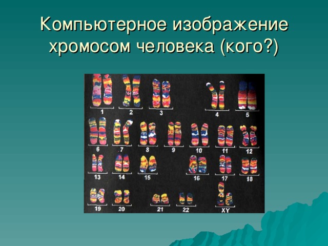 Компьютерное изображение хромосом человека (кого?) 