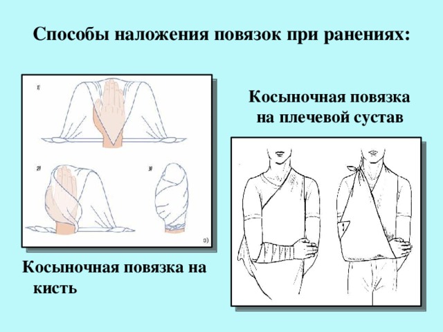 Метод наложения. Косыночная повязка показания. Наложение косыночной повязки на руку алгоритм. Повязка Косыночная детская ПКД-01. Наложение косыночной повязки на кисть.