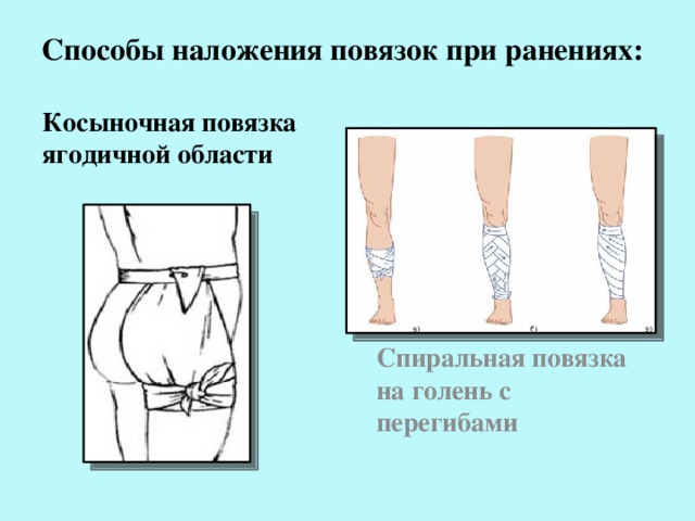 План по рассказу почему повязка на ноге