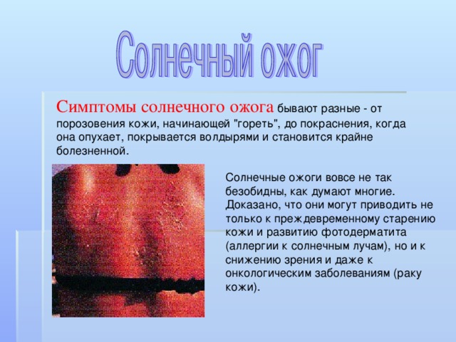 Как выглядит ожог кожи Ожоги.Виды Ожогов.Солнечные ожоги