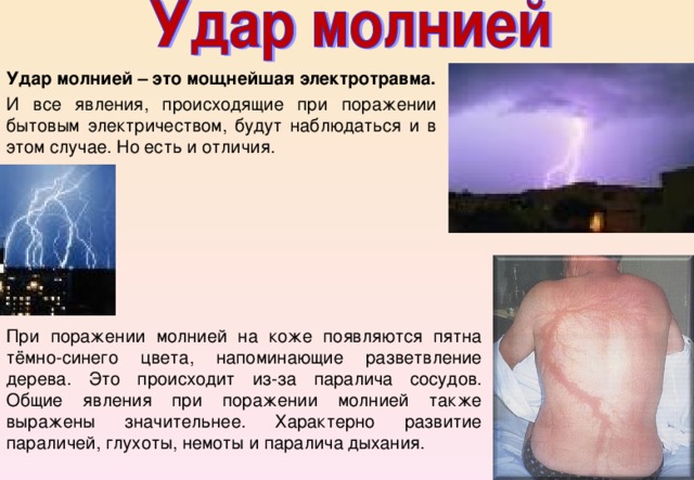 Удар молнией – это мощнейшая электротравма. И все явления, происходящие при поражении бытовым электричеством, будут наблюдаться и в этом случае. Но есть и отличия. При поражении молнией на коже появляются пятна тёмно-синего цвета, напоминающие разветвление дерева. Это происходит из-за паралича сосудов. Общие явления при поражении молнией также выражены значительнее. Характерно развитие параличей, глухоты, немоты и паралича дыхания. 
