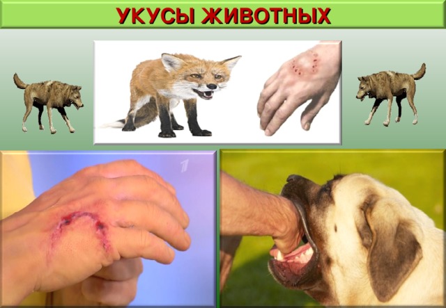 УКУСЫ ЖИВОТНЫХ 