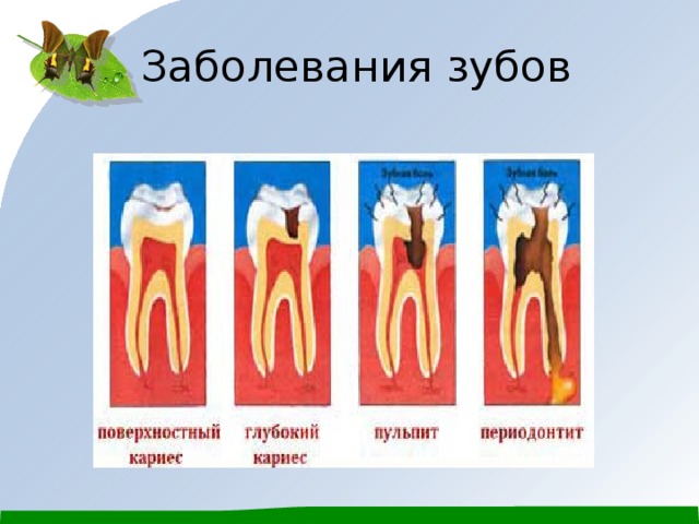 Классификация поражений зубов