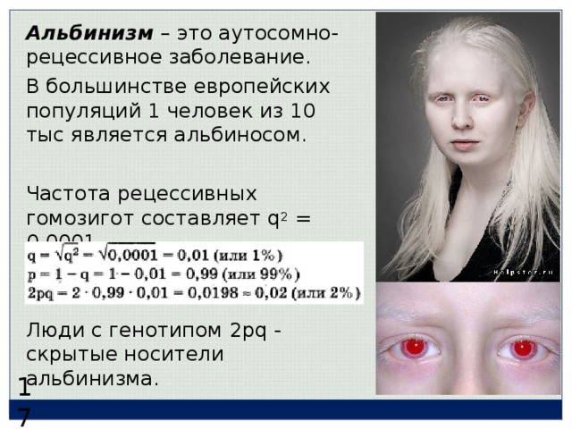 Альбинизм  – это аутосомно-рецессивное заболевание. В большинстве европейских популяций 1 человек из 10 тыс является альбиносом. Частота рецессивных гомозигот составляет q 2 = 0,0001 . Люди с генотипом 2 pq - скрытые носители альбинизма. 17  