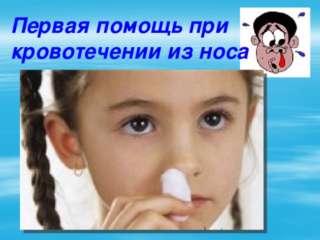 Первая помощь при кровотечении из носа 