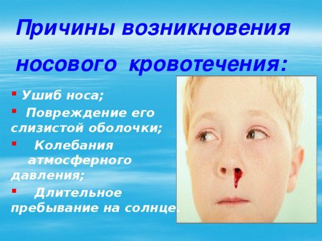 Причины возникновения носового кровотечения:   Ушиб носа;  Повреждение его слизистой оболочки;  Колебания атмосферного давления;  Длительное пребывание на солнце. 
