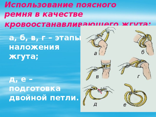 Использование поясного  ремня в качестве  кровоостанавливающего жгута:  а, б, в, г – этапы наложения жгута;  д, е – подготовка двойной петли. 