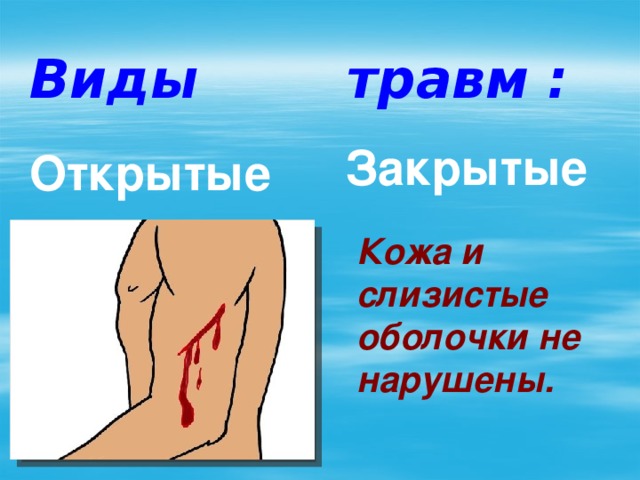 Виды травм :  Закрытые Открытые Кожа и слизистые оболочки не нарушены.  Вызывают кровотечения. 