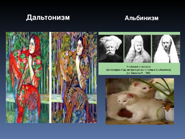  Дальтонизм Альбинизм  