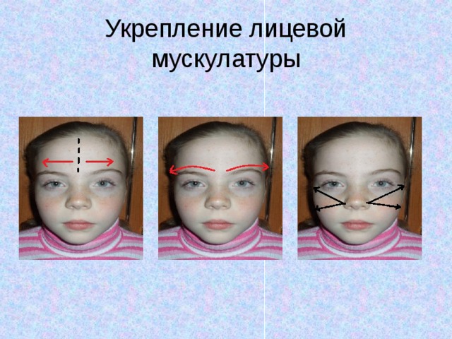 Укрепление лицевой мускулатуры 