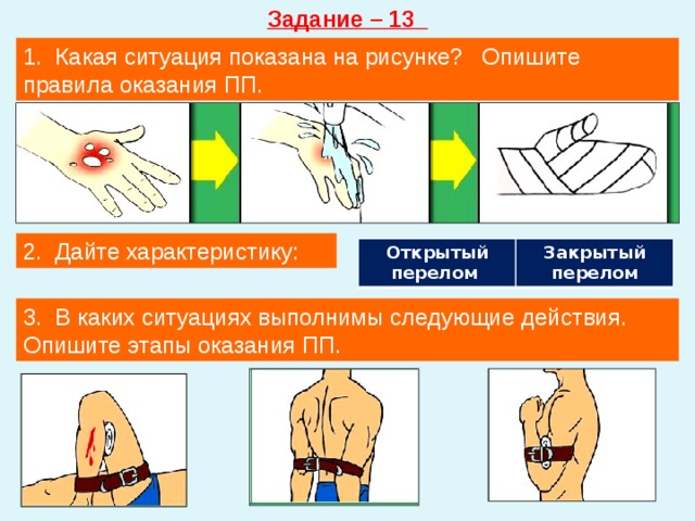 Задание – 13 1. Какая ситуация показана на рисунке? Опишите правила оказания ПП. 2. Дайте характеристику: Открытый перелом Закрытый перелом 3. В каких ситуациях выполнимы следующие действия. Опишите этапы оказания ПП. 