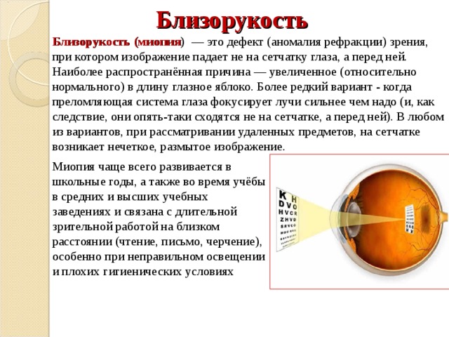 При рассматривании предмета на далеком расстоянии четкое изображение на сетчатке глаза не возникает