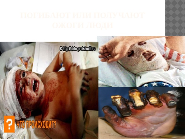 Погибают или получают ожоги люди 