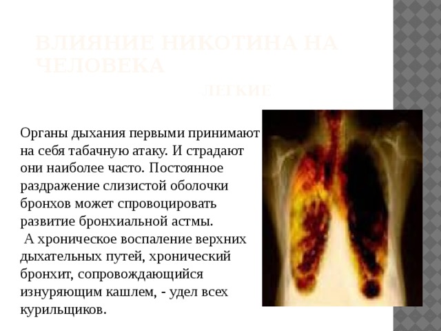 Влияние никотина на человека   Легкие Органы дыхания первыми принимают на себя табачную атаку. И страдают они наиболее часто. Постоянное раздражение слизистой оболочки бронхов может спровоцировать развитие бронхиальной астмы.  А хроническое воспаление верхних дыхательных путей, хронический бронхит, сопровождающийся изнуряющим кашлем, - удел всех курильщиков.