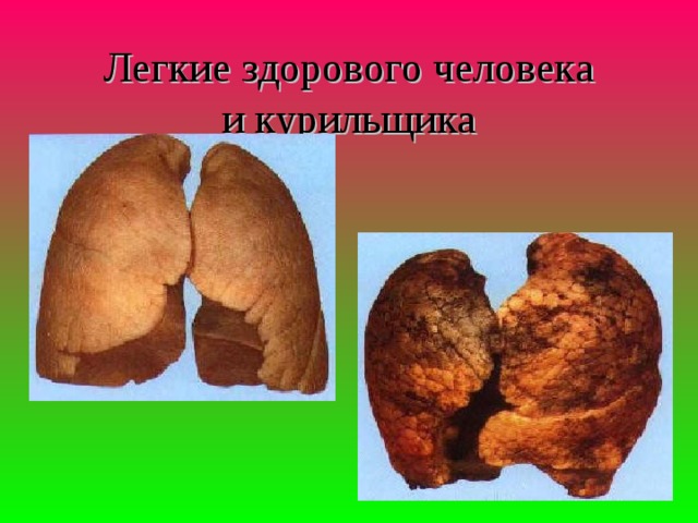 Легкие здорового человека  и курильщика