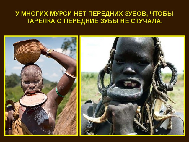 У МНОГИХ МУРСИ НЕТ ПЕРЕДНИХ ЗУБОВ, ЧТОБЫ ТАРЕЛКА О ПЕРЕДНИЕ ЗУБЫ НЕ СТУЧАЛА. 