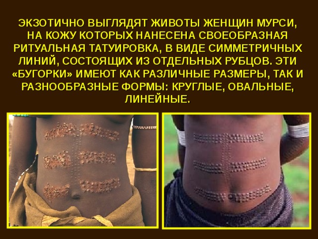 ЭКЗОТИЧНО ВЫГЛЯДЯТ ЖИВОТЫ ЖЕНЩИН МУРСИ, НА КОЖУ КОТОРЫХ НАНЕСЕНА СВОЕОБРАЗНАЯ РИТУАЛЬНАЯ ТАТУИРОВКА, В ВИДЕ СИММЕТРИЧНЫХ ЛИНИЙ, СОСТОЯЩИХ ИЗ ОТДЕЛЬНЫХ РУБЦОВ. ЭТИ «БУГОРКИ» ИМЕЮТ КАК РАЗЛИЧНЫЕ РАЗМЕРЫ, ТАК И РАЗНООБРАЗНЫЕ ФОРМЫ: КРУГЛЫЕ, ОВАЛЬНЫЕ, ЛИНЕЙНЫЕ. 
