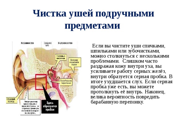  Чистка ушей подручными предметами    Если вы чистите уши спичками, шпильками или зубочистками, можно столкнуться с несколькими проблемами. Слишком часто раздражая кожу внутри уха, вы усиливаете работу серных желёз, внутри образуется серная пробка. В итоге ухудшается слух. Если серная пробка уже есть, вы можете протолкнуть её внутрь. Наконец, велика вероятность повредить барабанную перепонку. 