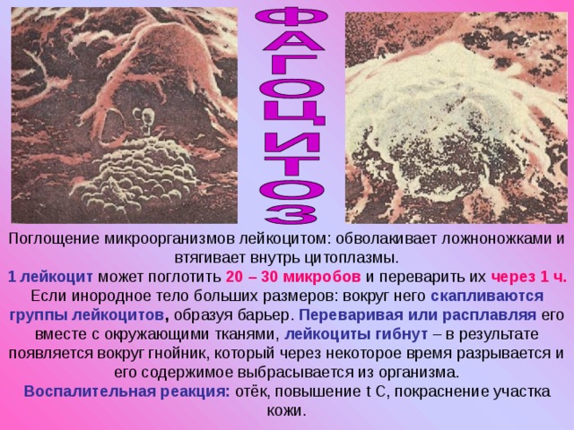 Поглощение микроорганизмов лейкоцитом: обволакивает ложноножками и втягивает внутрь цитоплазмы.  1 лейкоцит может поглотить 20 – 30 микробов и переварить их через 1 ч.  Если инородное тело больших размеров: вокруг него скапливаются группы лейкоцитов , образуя барьер. Переваривая или расплавляя его вместе с окружающими тканями, лейкоциты гибнут – в результате появляется вокруг гнойник, который через некоторое время разрывается и его содержимое выбрасывается из организма.  Воспалительная реакция: отёк, повышение t C , покраснение участка кожи. 