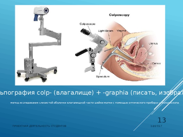 Кольпография  colp- (влагалище) + -graphia (писать, изображать)  метод исследования слизистой оболочки влагалищной части шейки матки с помощью оптического прибора — кольпоскопа.  12/27/17 ПРОЕКТНАЯ ДЕЯТЕЛЬНОСТЬ СТУДЕНТОВ 