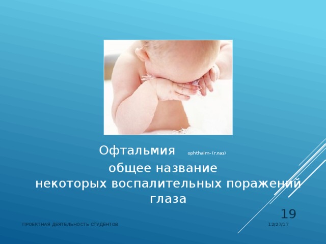 Офтальмия   ophthalm- (глаз) общее название некоторых воспалительных поражений глаза  12/27/17 ПРОЕКТНАЯ ДЕЯТЕЛЬНОСТЬ СТУДЕНТОВ 