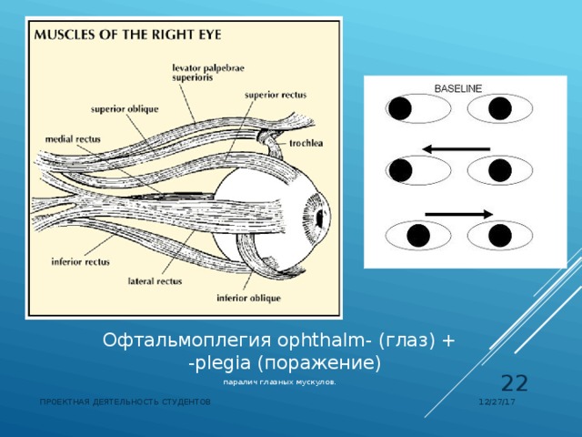 Офтальмоплегия  ophthalm- (глаз) + -plegia (поражение)  паралич глазных мускулов.  12/27/17 ПРОЕКТНАЯ ДЕЯТЕЛЬНОСТЬ СТУДЕНТОВ 