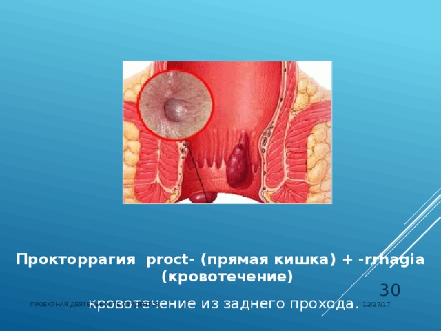 Прокторрагия  proct- (прямая кишка) + -rrhagia (кровотечение)  кровотечение из заднего прохода.  12/27/17 ПРОЕКТНАЯ ДЕЯТЕЛЬНОСТЬ СТУДЕНТОВ  