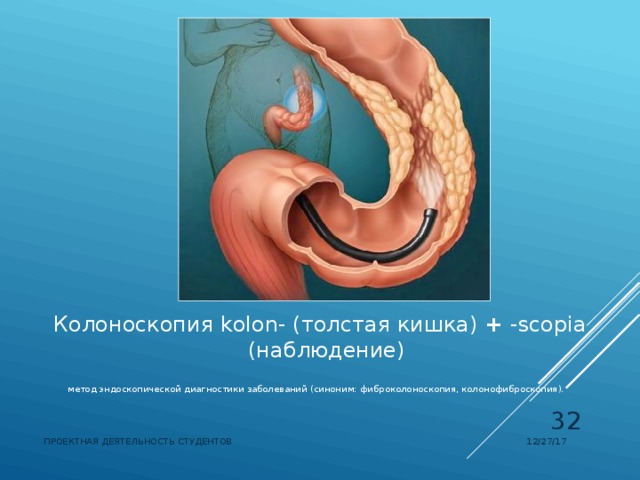 Колоноскопия  kolon- (толстая кишка) + -scopia (наблюдение) метод эндоскопической диагностики заболеваний (синоним: фиброколоноскопия, колонофиброскопия).   12/27/17 ПРОЕКТНАЯ ДЕЯТЕЛЬНОСТЬ СТУДЕНТОВ 