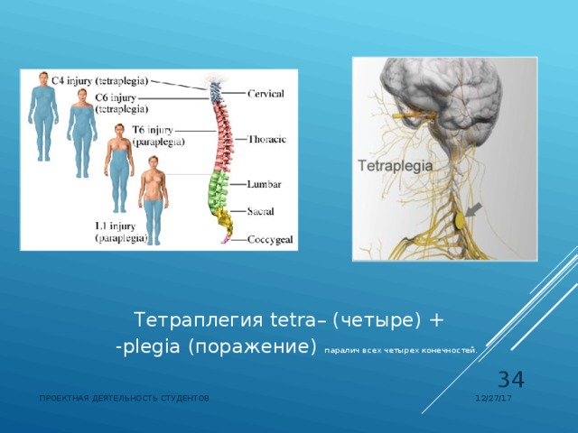 Тетраплегия  tetra– (четыре) + -plegia (поражение)  паралич всех четырех конечностей.   12/27/17 ПРОЕКТНАЯ ДЕЯТЕЛЬНОСТЬ СТУДЕНТОВ 