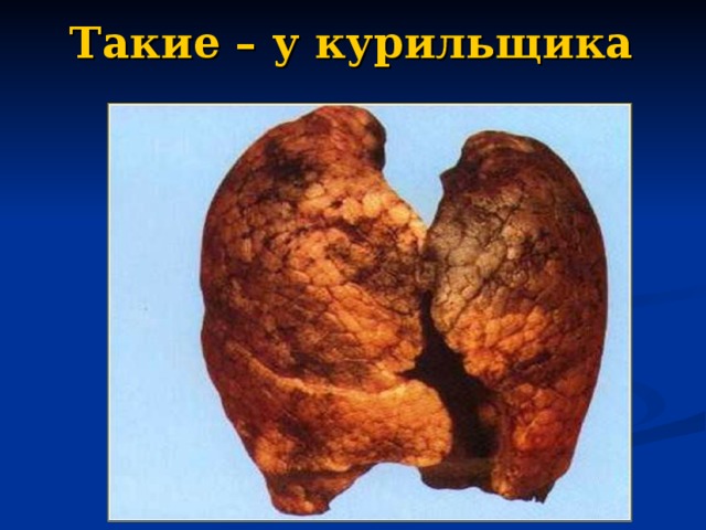 Такие – у курильщика  