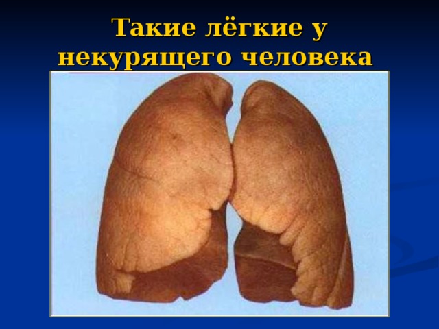 Такие лёгкие у некурящего человека  