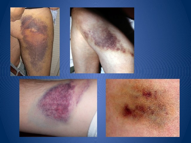 Жетілген әйелдерге арналған лесбиянкалық массаж онлайн порно