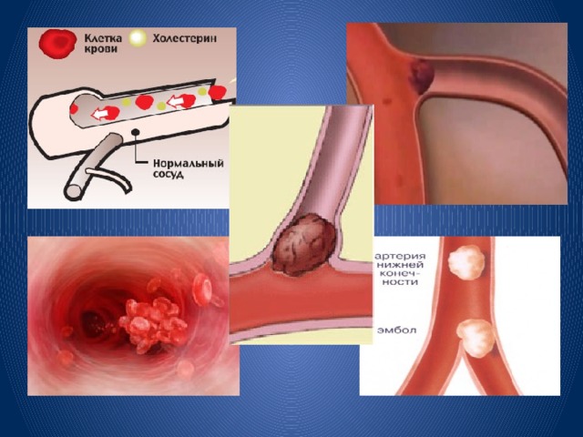 Сексуалдық құлдың писауы