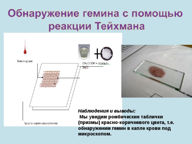 Наблюдения и выводы:   Мы увидим ромбические таблички (призмы) красно-коричневого цвета, т.е. обнаруженим гемин в капле крови под микроскопом. 