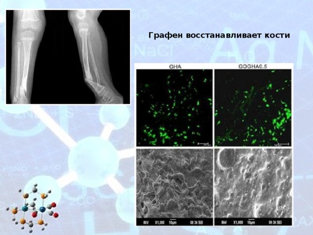 Графен восстанавливает кости