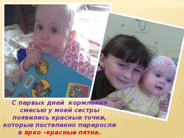 С первых дней кормления смесью у моей сестры появились красные точки, которые постепенно переросли в ярко –красные пятна . 