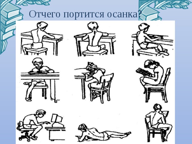 Отчего портится осанка? Черник Е.Н. 