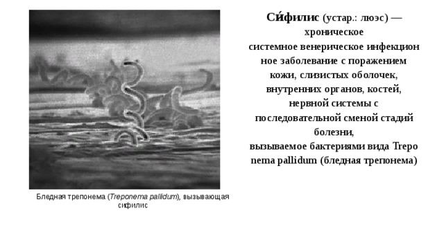 Спирохеты вызывают заболевания. Treponema pallidum входные ворота. Сифилис вызывается бактериями рода 12 букв.