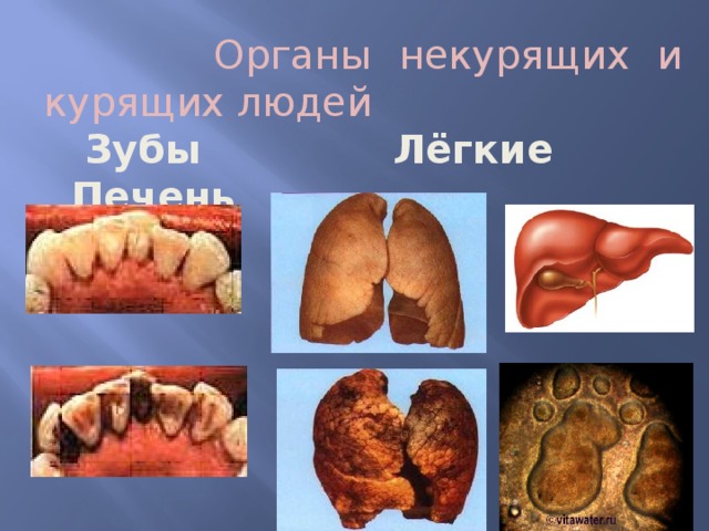  Органы некурящих и курящих людей  Зубы Лёгкие Печень   