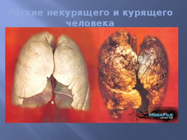 Лёгкие некурящего и курящего человека 