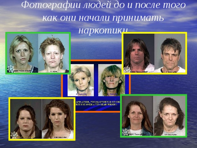 Фотографии людей до и после того как они начали принимать наркотики 