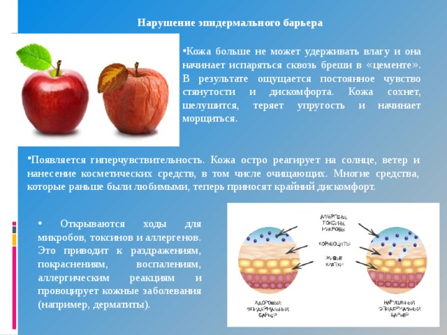 Обезвоживание кожи и разрушение эпидермального барьера - фото презентация