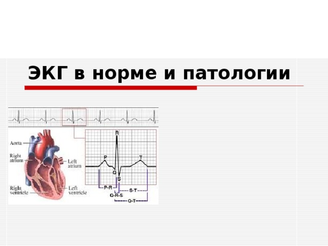ЭКГ в норме и патологии 