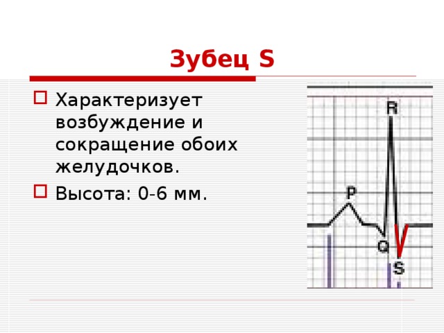 Зубец S Характеризует возбуждение и сокращение обоих желудочков. Высота: 0-6 мм. 