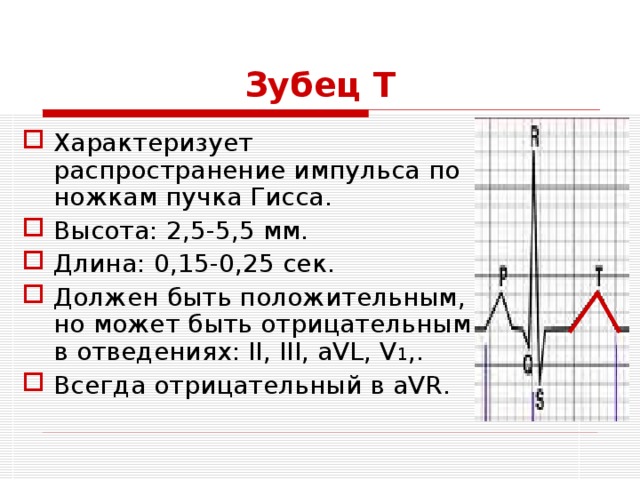 Экг отрицательный. Отрицательные зубцы т на ЭКГ В v2 v5. ЭКГ зубец t отрицательный в v1. Отрицательный зубец т на ЭКГ В v1 v2. Отрицательный зубец т на ЭКГ В 3 отведении.