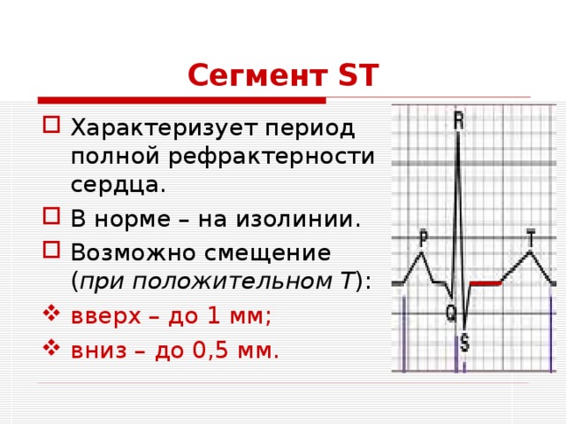 Сегмент ST Характеризует период полной рефрактерности сердца. В норме – на изолинии. Возможно смещение ( при положительном Т ): вверх – до 1 мм; вниз – до 0,5 мм. 
