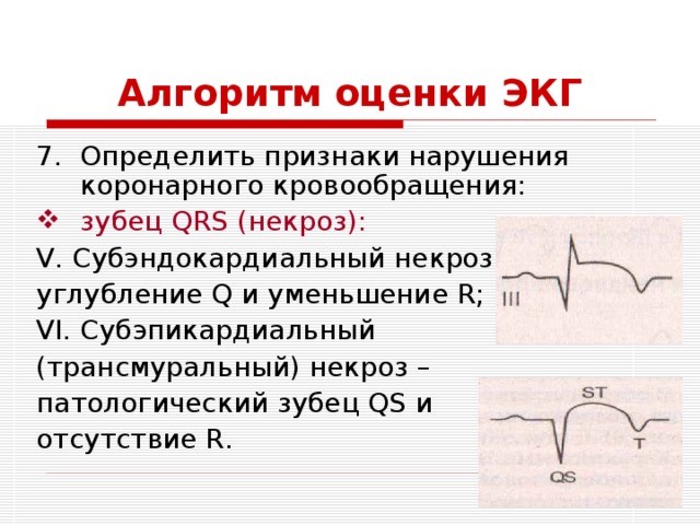 Алгоритм оценки ЭКГ Определить признаки нарушения коронарного кровообращения: зубец QRS (некроз): V. Субэндокардиальный некроз – углубление Q и уменьшение R; VI. Субэпикардиальный (трансмуральный) некроз – патологический зубец QS и отсутствие R. 